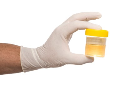 как да правите тестове за урина правилно